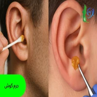 جرم گوش